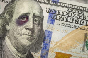An up-close shot of Benjamin Franklin with a bruised eye and sad face on the hundred-dollar bill.